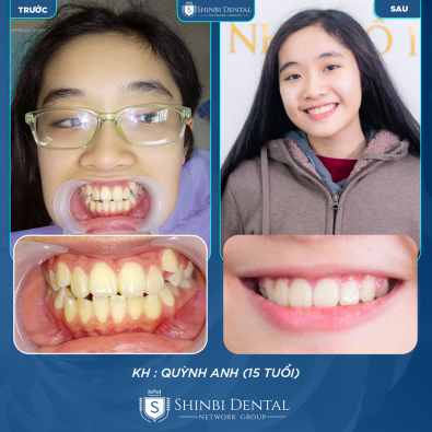 Khách hàng Quỳnh Anh